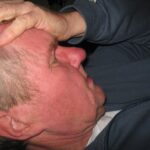 Immagine che illustra la relazione tra tensione della mandibola e acufene.